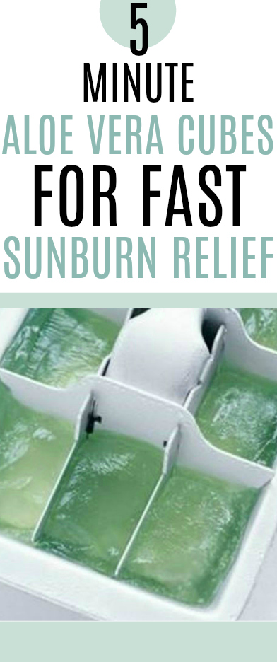 DIY Sunburn Relief - Aloe Ice Cubes