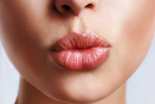 How To Heal Chapped Lips